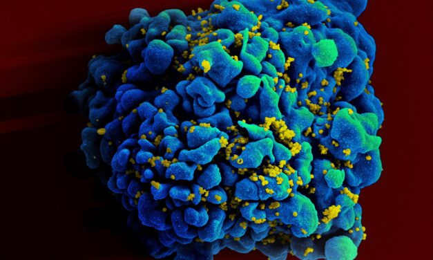 Whatever happened to … the race to cure HIV? There’s promising news