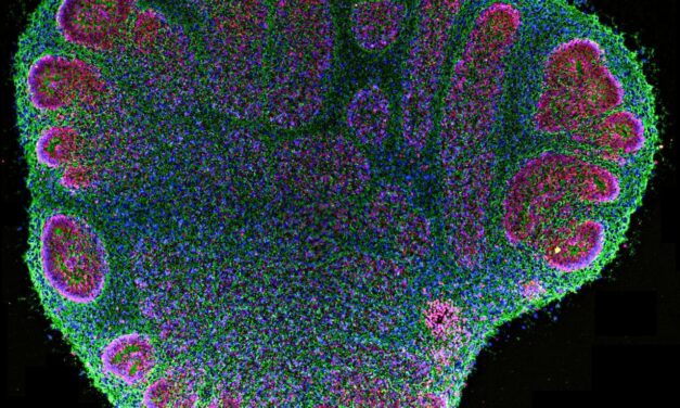 Brain organoids are helping researchers, but their use also creates unease