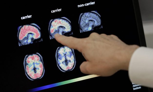 Can Chinese AI solve inequality? + How dementia comes for your bank account